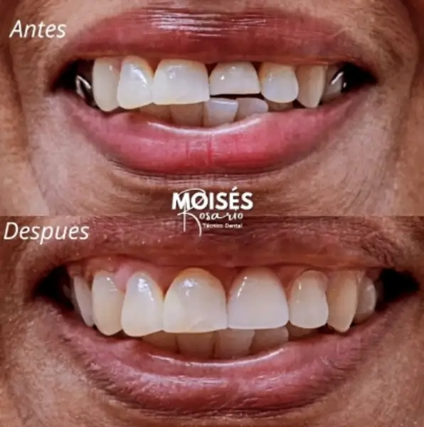 Muestra 3